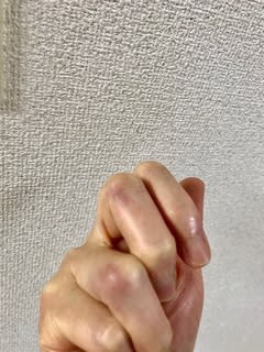 派手に転びました。