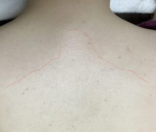 プラセリアをつけたところ、つけていないところ。